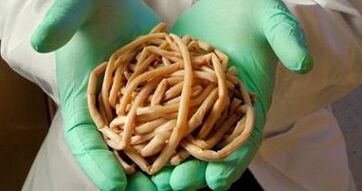 паразітаў, вынятых з арганізма чалавека