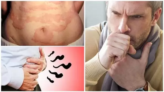 Алергія, кашаль і ўздуцце - прыкметы паразы арганізма глістамі